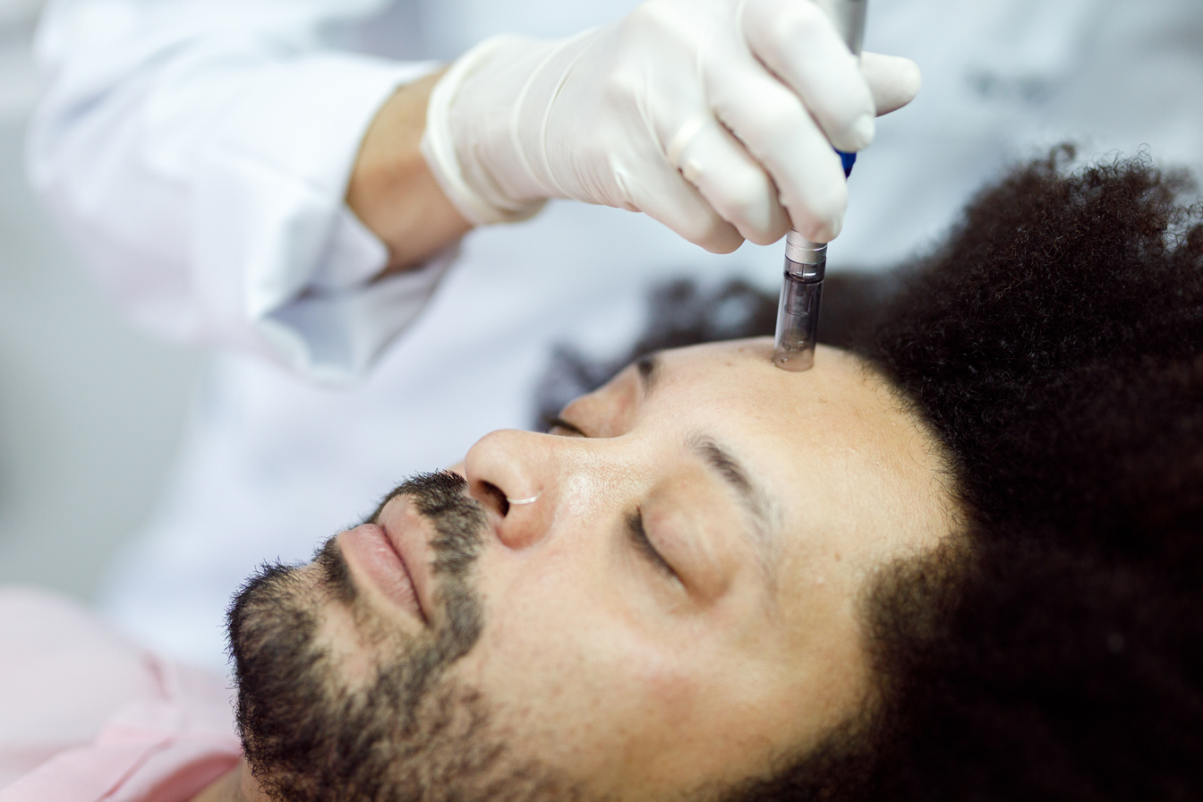 Man receiving a microneedling treatment on his face